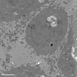 说明: F:\Publish\Euphorbia esula  induced apoptosis\EM\WD_7.jpg